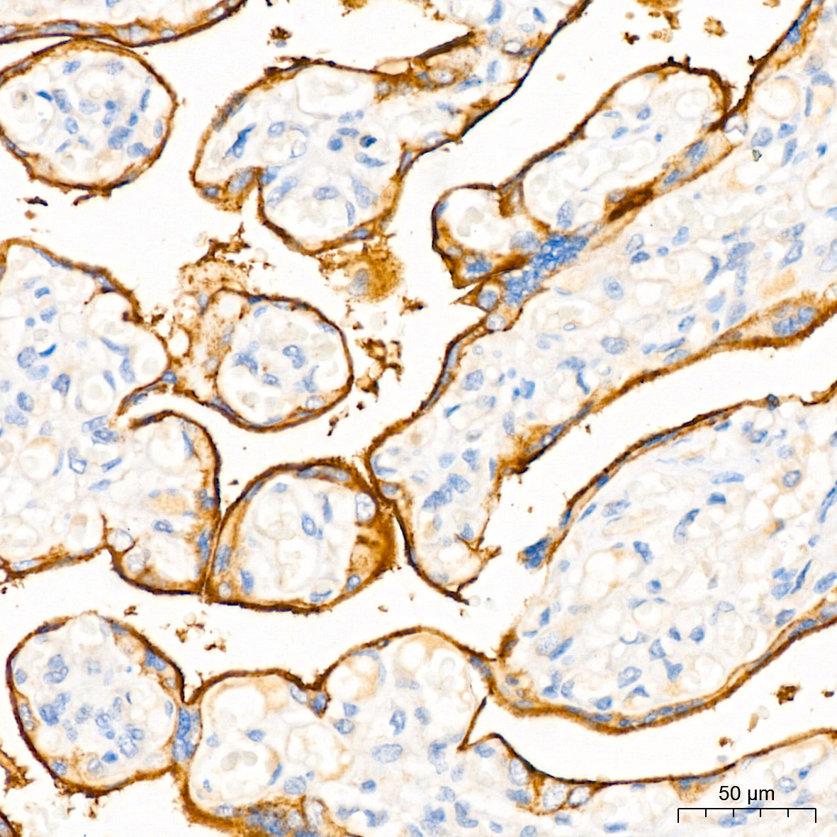 EGFR Rabbit monoclonal antibody