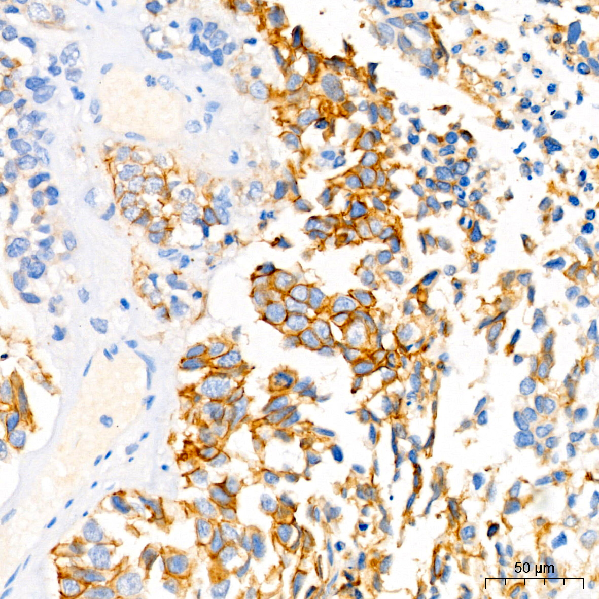 EGFR Rabbit monoclonal antibody