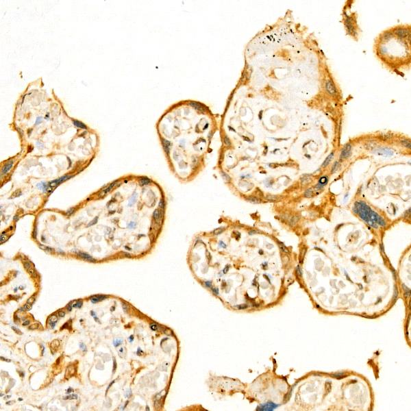 Bcl-XL Rabbit monoclonal antibody