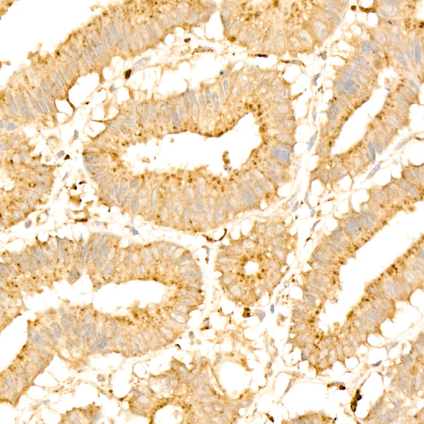Legumain (LGMN) Rabbit monoclonal antibody