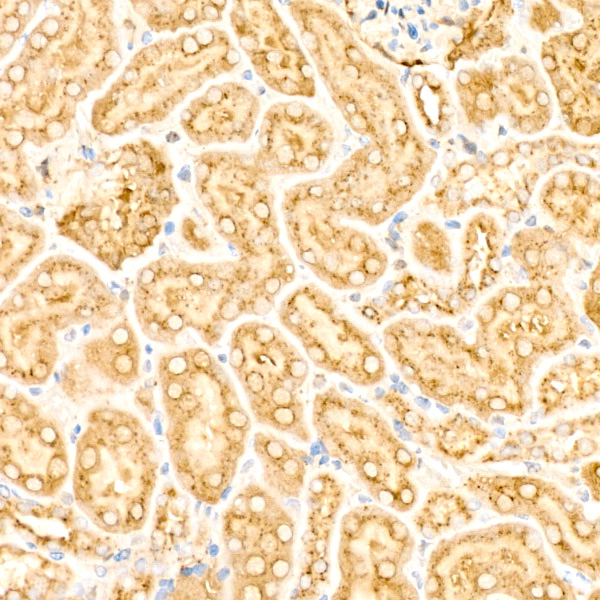 Legumain (LGMN) Rabbit monoclonal antibody