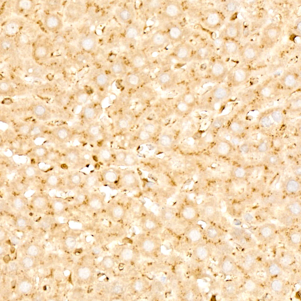 Legumain (LGMN) Rabbit monoclonal antibody