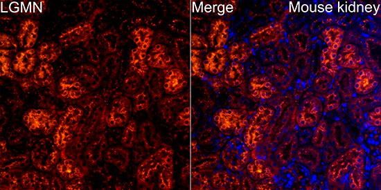Legumain (LGMN) Rabbit monoclonal antibody