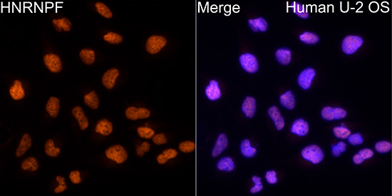 hnRNP F Rabbit monoclonal antibody