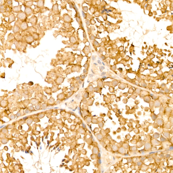 [KD Validated] TOLLIP Rabbit monoclonal antibody