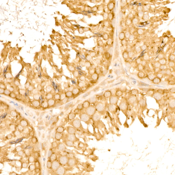 [KD Validated] TOLLIP Rabbit monoclonal antibody