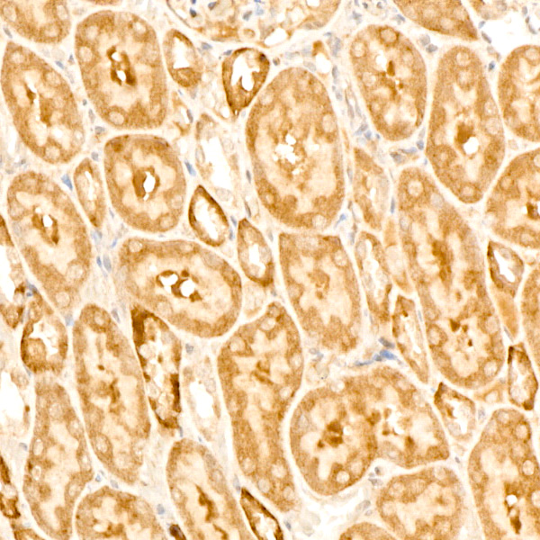GABARAPL1 Rabbit monoclonal antibody