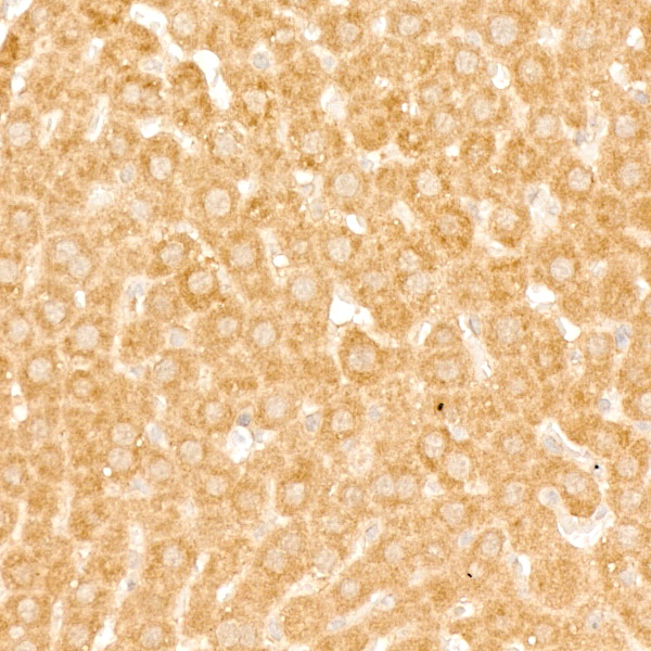 GABARAPL1 Rabbit monoclonal antibody
