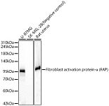Western blot - Fibroblast activation protein-α (FAP) Rabbit mAb (A23789)