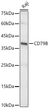 CD79B Rabbit monoclonal antibody