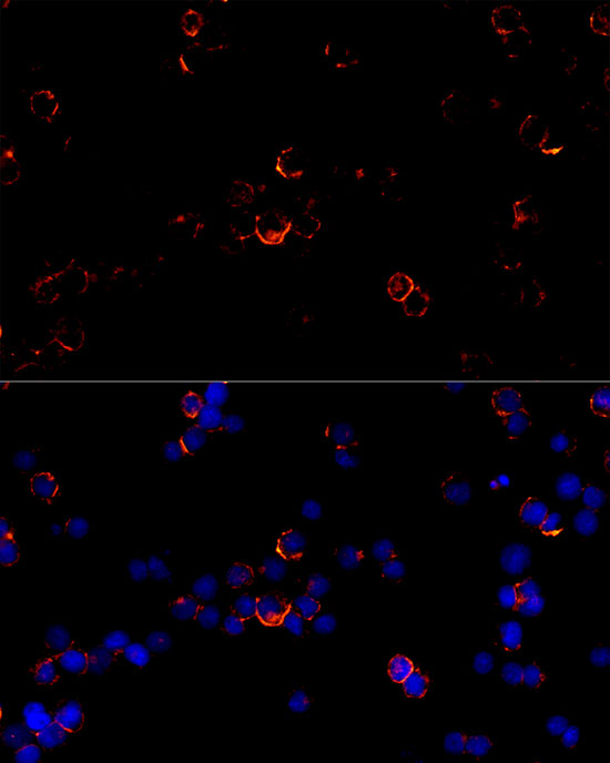 CD79B Rabbit monoclonal antibody