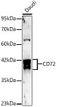 Western blot - CD72 Rabbit mAb (A23791)