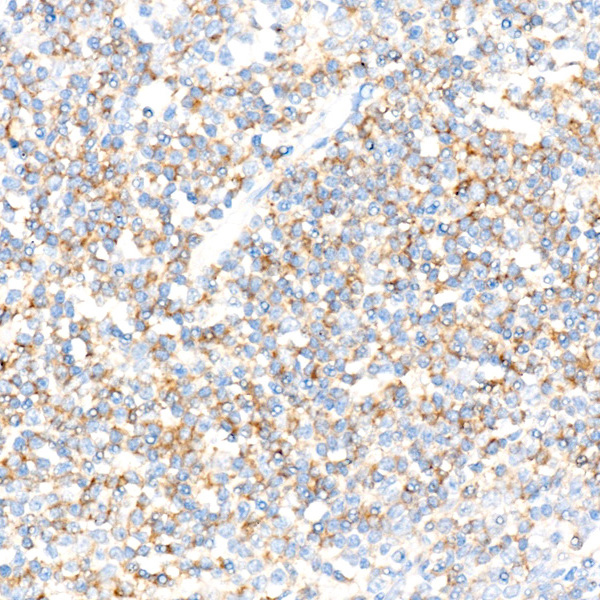 CD72 Rabbit monoclonal antibody