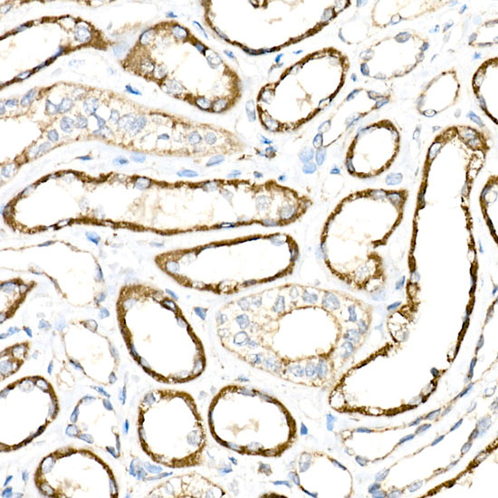 BCAT2 Rabbit monoclonal antibody