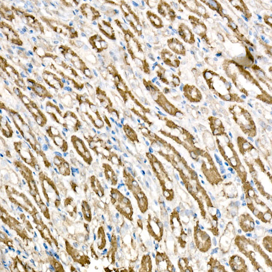 BCAT2 Rabbit monoclonal antibody