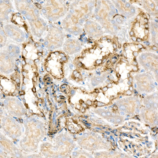 BCAT2 Rabbit monoclonal antibody