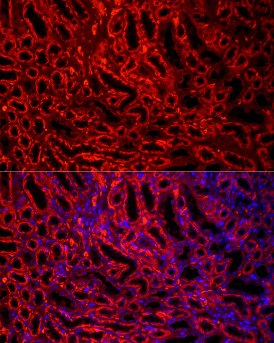 BCAT2 Rabbit monoclonal antibody