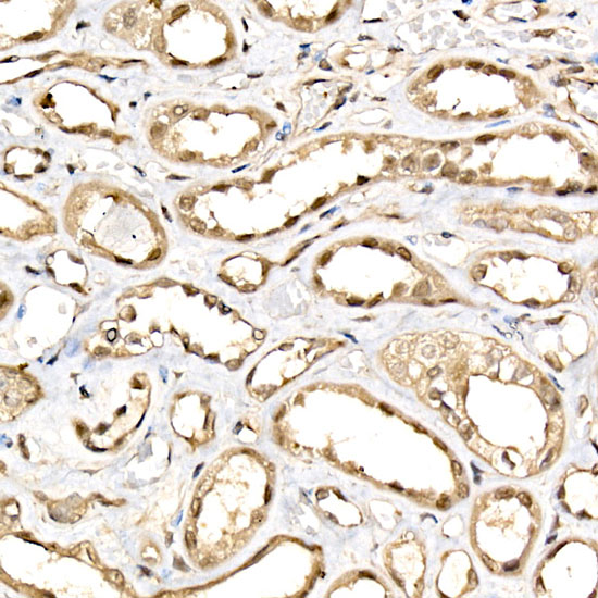 DDX3X/DDX3Y Rabbit monoclonal antibody