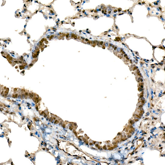 DDX3X/DDX3Y Rabbit monoclonal antibody