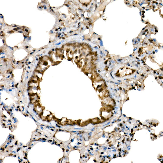 DDX3X/DDX3Y Rabbit monoclonal antibody