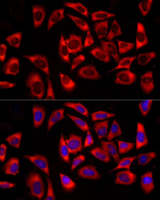 DDX3X/DDX3Y Rabbit monoclonal antibody