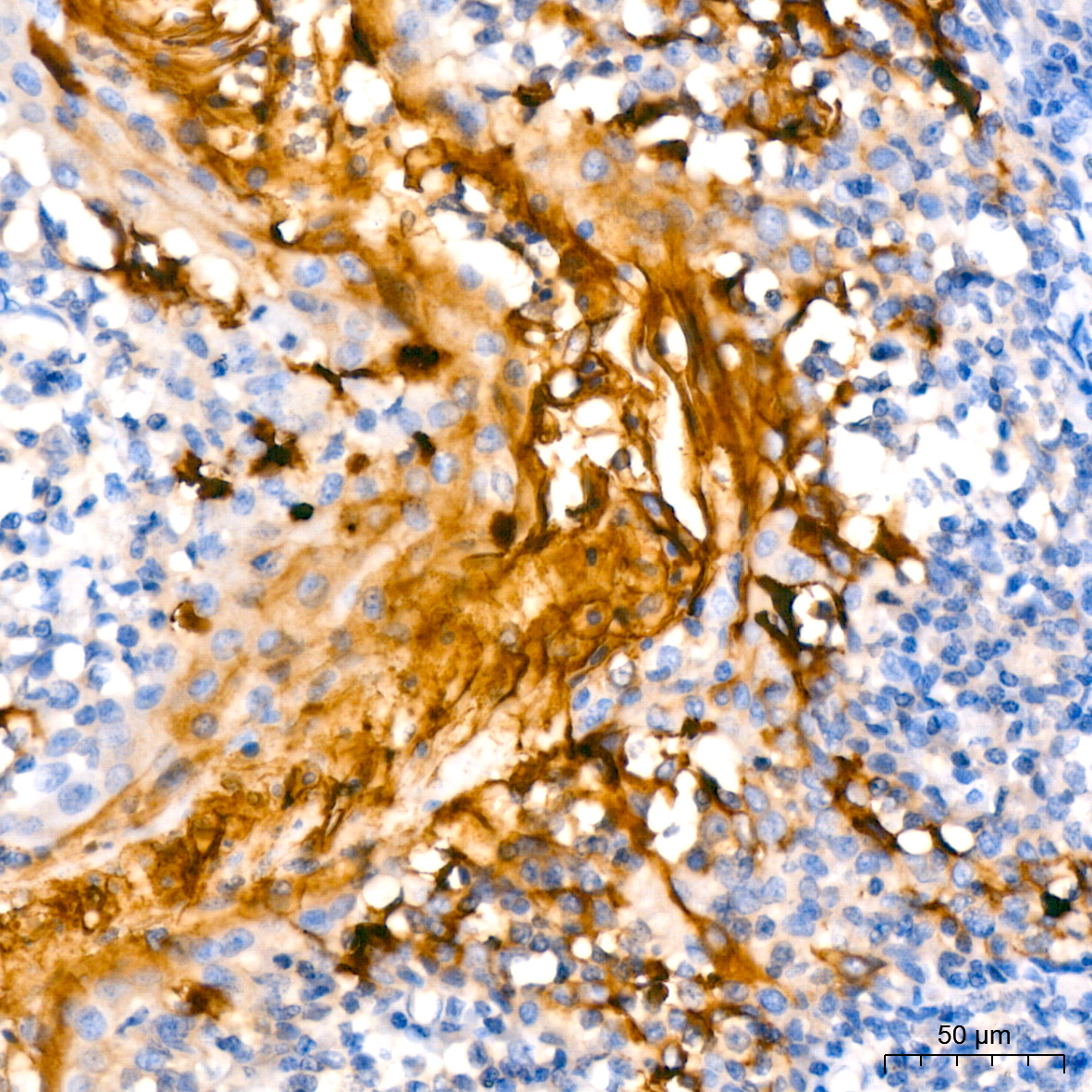 Mesothelin Rabbit monoclonal antibody