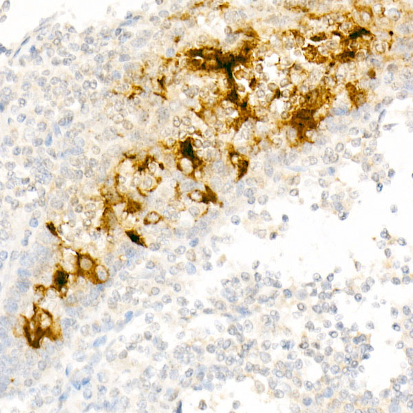 Mesothelin Rabbit monoclonal antibody