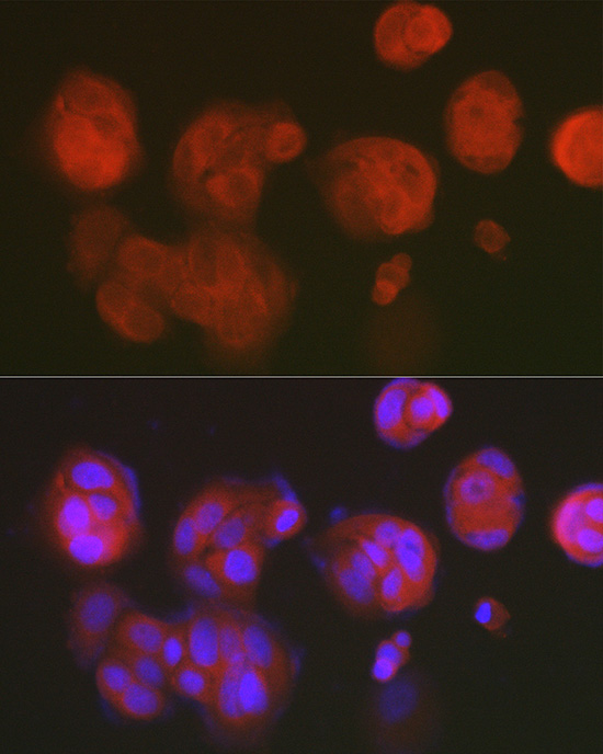DNPH1 Rabbit monoclonal antibody