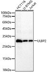 Western blot - ULBP2 Rabbit mAb (A23828)