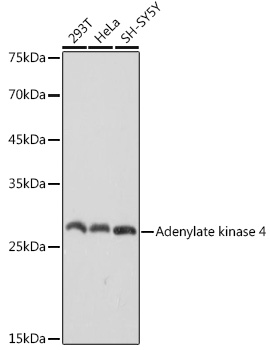 Adenylate kinase 4 Rabbit monoclonal antibody