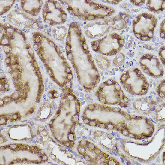 Adenylate kinase 4 Rabbit monoclonal antibody