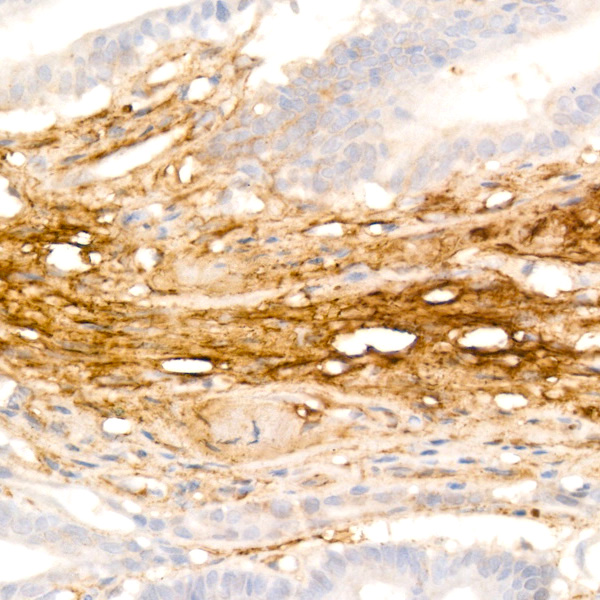 Fibronectin Rabbit monoclonal antibody