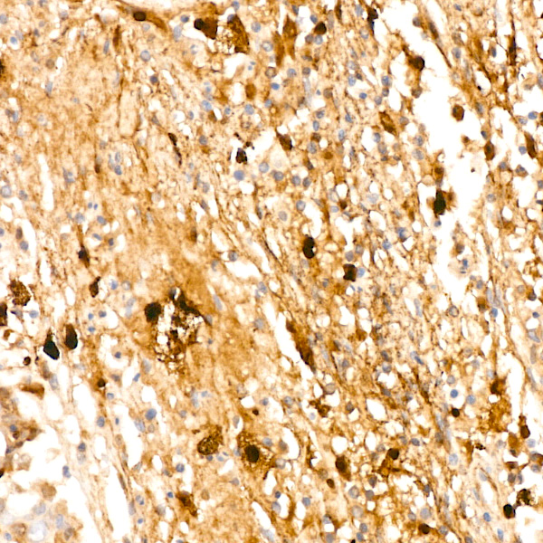 Fibronectin Rabbit monoclonal antibody