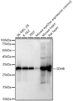 SDHB Rabbit monoclonal antibody