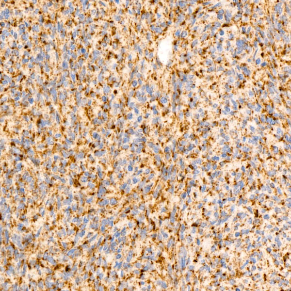 SDHB Rabbit monoclonal antibody