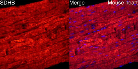 SDHB Rabbit monoclonal antibody