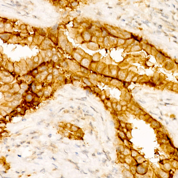 Claudin-4 Rabbit monoclonal antibody