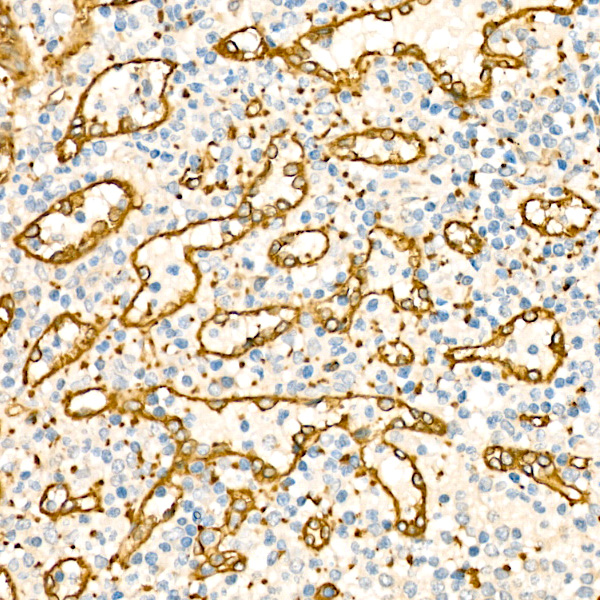 CAVIN2 Rabbit polyclonal antibody