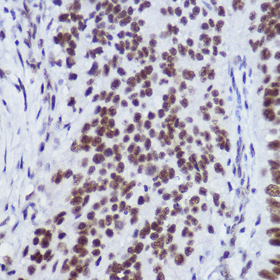 USP39 Rabbit monoclonal antibody