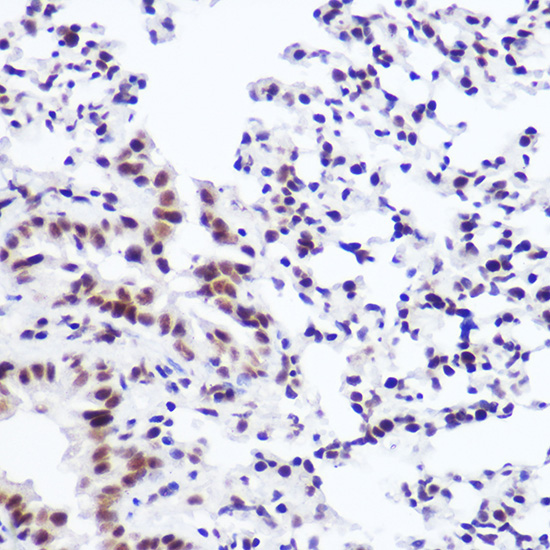 USP39 Rabbit monoclonal antibody