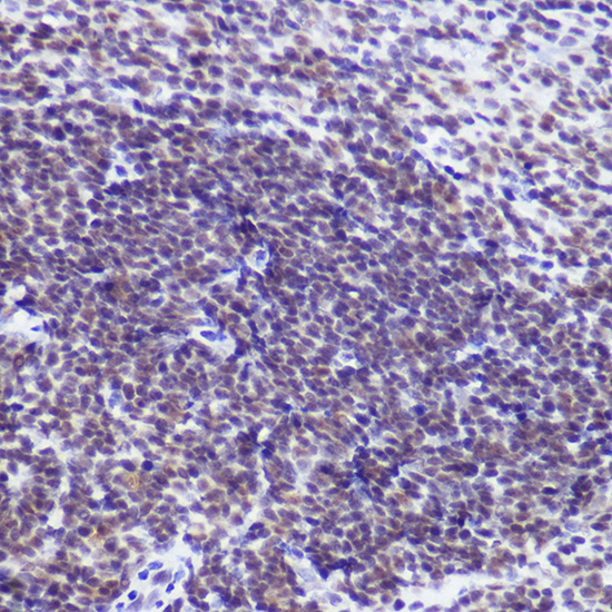 USP39 Rabbit monoclonal antibody