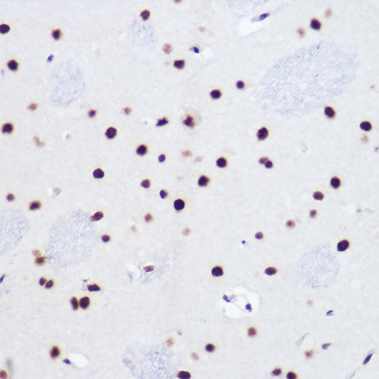 USP39 Rabbit monoclonal antibody