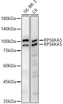 RPS6KA5 Rabbit monoclonal antibody