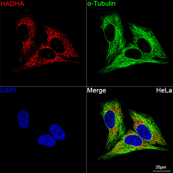 [KO Validated] HADHA Rabbit monoclonal antibody