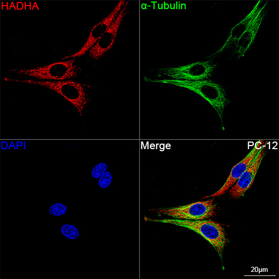 [KO Validated] HADHA Rabbit monoclonal antibody