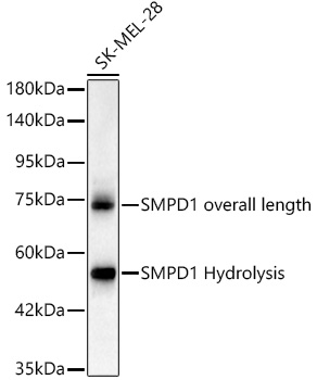 [KO Validated] SMPD1 Rabbit monoclonal antibody
