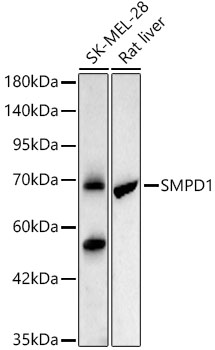 [KO Validated] SMPD1 Rabbit monoclonal antibody
