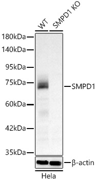 [KO Validated] SMPD1 Rabbit monoclonal antibody