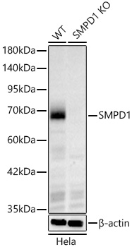 [KO Validated] SMPD1 Rabbit monoclonal antibody