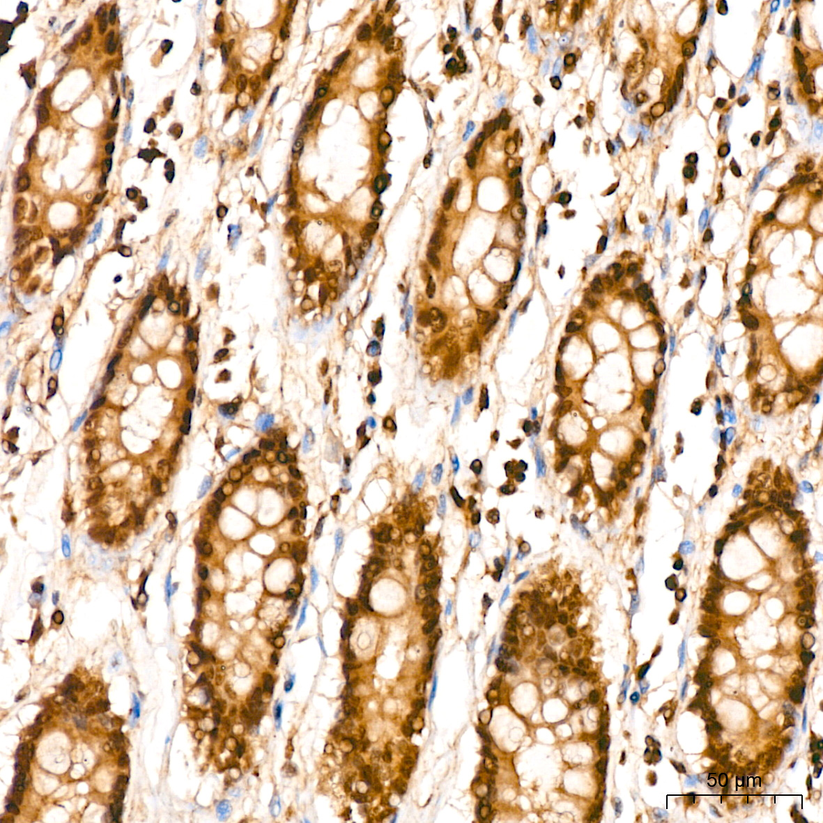 UBE2L6 Rabbit monoclonal antibody
